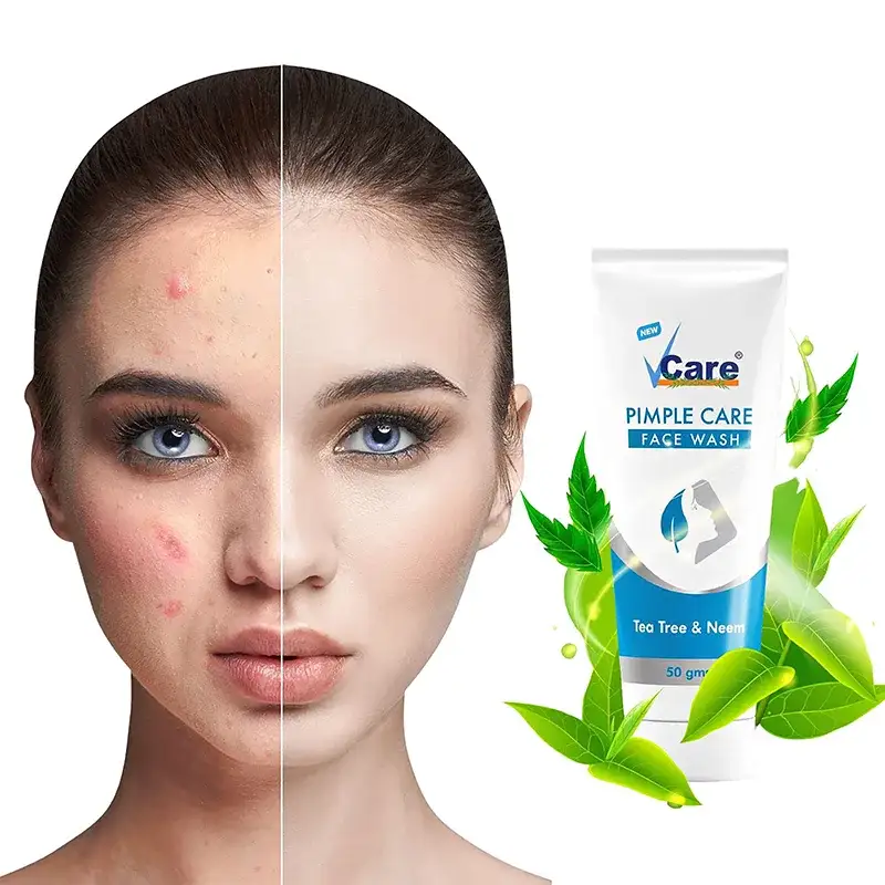 Face wash,Pimple care face wash,Vcare pimple face wash,face wash for men and women,Face cleanser